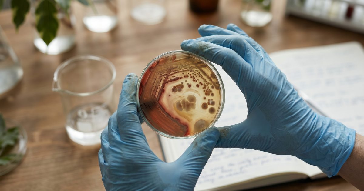How Your Gut Microbiome Quietly Drives Cognitive Frailty and Muscle Loss