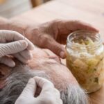 Acupuncture May Boost Memory in MCI - and Gut Bacteria Could Be Why