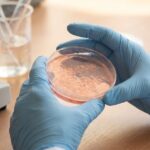 Scientists Find the Gut-Barrier Breakdown Behind Gout Attacks