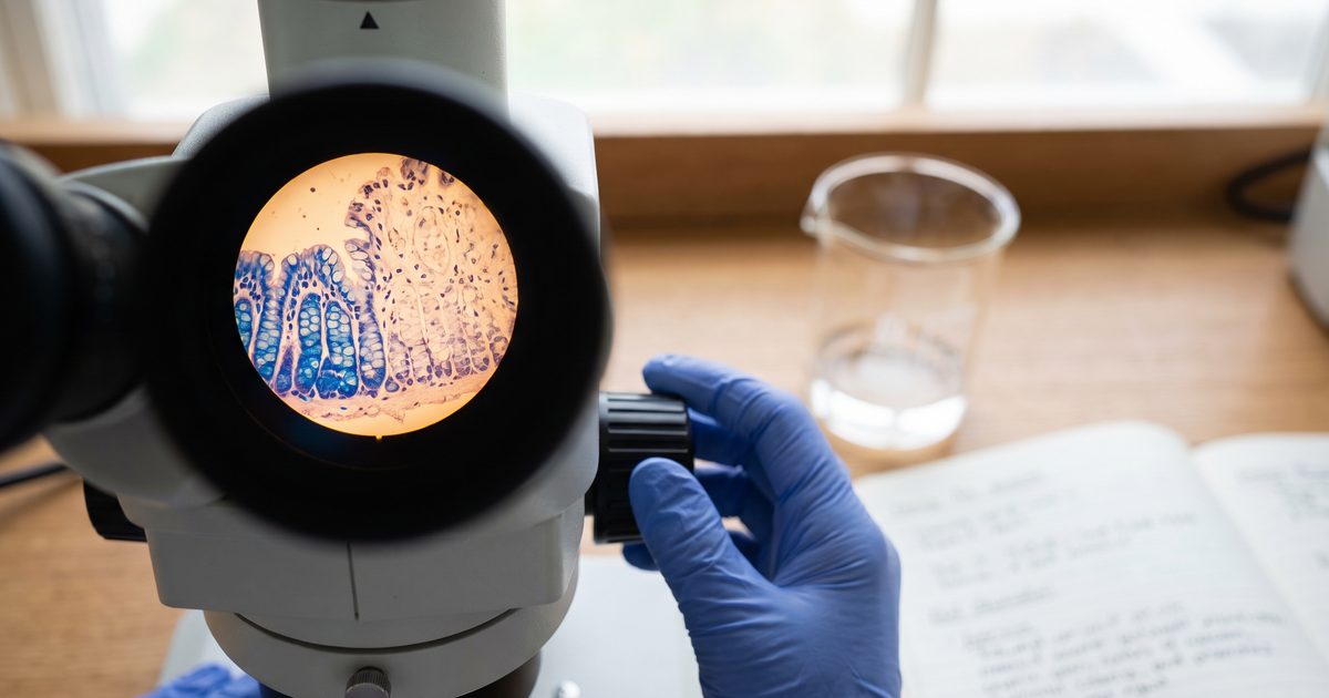 Blocking One Receptor Fully Protected Aging Gut Stem Cells in Mice