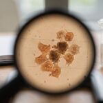 This gut bacterium's protein shrinks colon tumors by rewiring immune cells