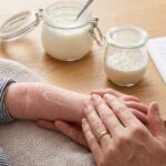 Infant Skin Bacteria Show Signs of Eczema and Food Allergy Before Diagnosis