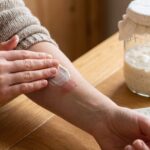 A vanishing skin bacterium may explain psoriasis flare-ups