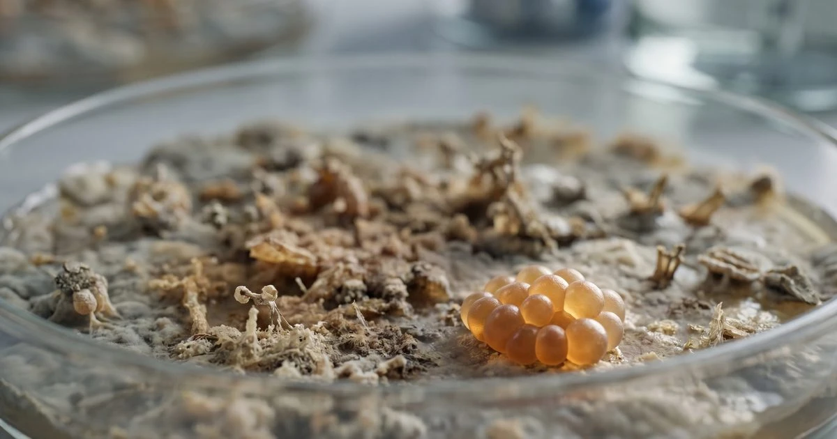 Gout Patients Have a Gut Microbiome in Ecological Freefall, New Study Reveals