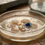 How a Disrupted Gut Microbiome Quietly Destroys Your Kidneys Through Uric Acid