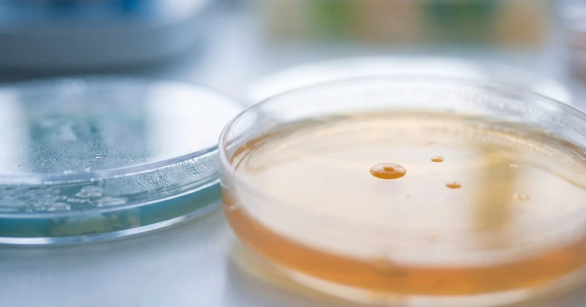 Chronic Constipation Doubles Anorexia Risk, Study of 1.2 Million Patients Finds