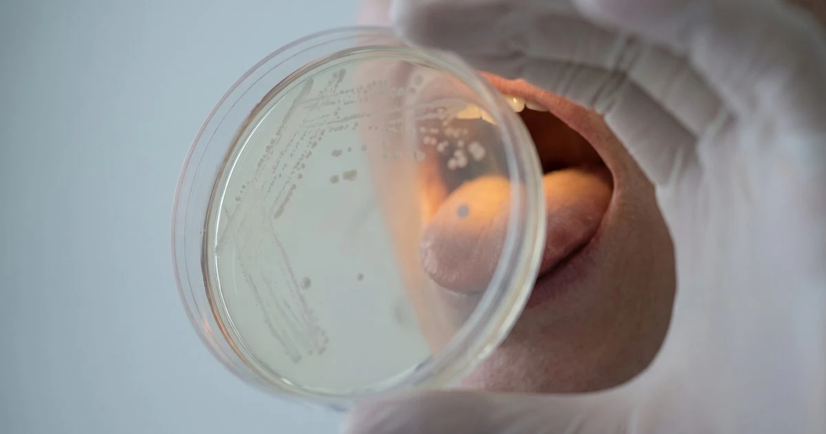 Your Mouth's Bacteria May Reflect Your Metabolic Health, Study Finds