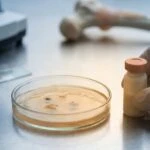 Heat-Killed Gut Bacteria Reversed Obesity-Linked Bone Loss in Mice. Here's How.