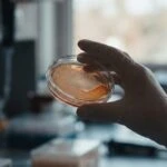 SIBO Clears in 63% of Cases With Rifaximin, But Recurrence Is the Real Problem